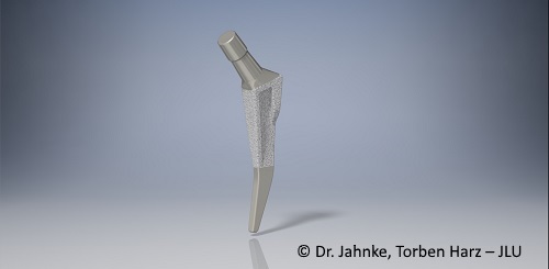 Short Shaft Prosthesis