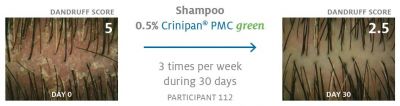 Einsatz Crinipan® PMC green vorher - nachher, © Symrise AG